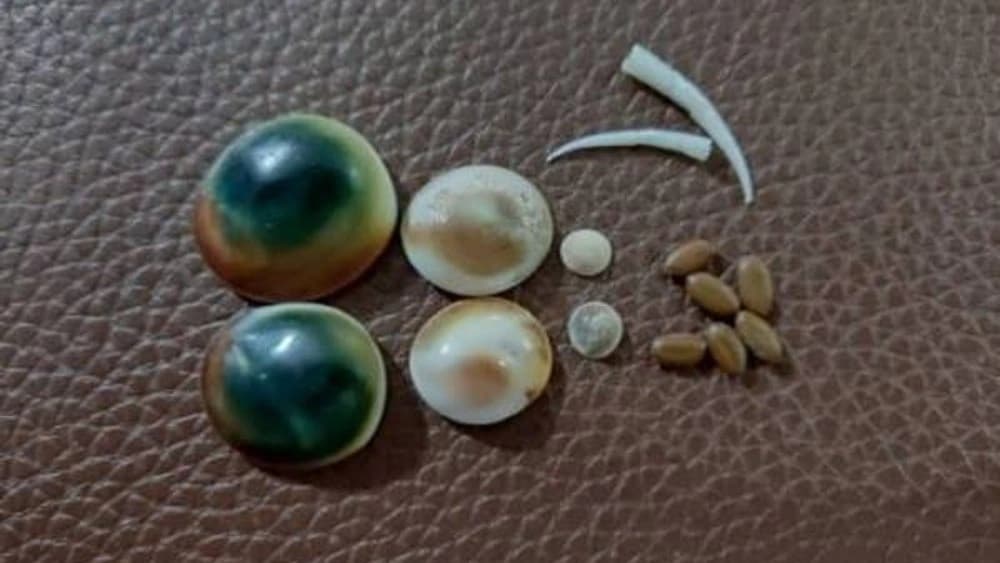 مهره مار ژن گستر در اردبیل